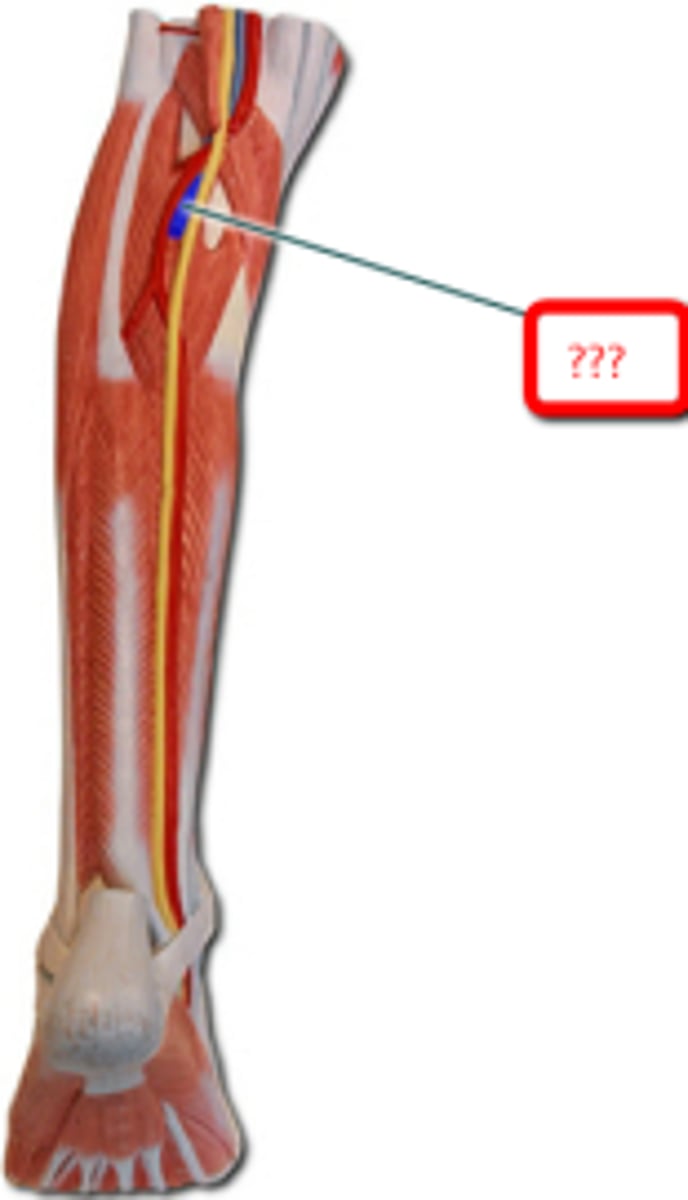 <p>Name the blood vessel.</p>