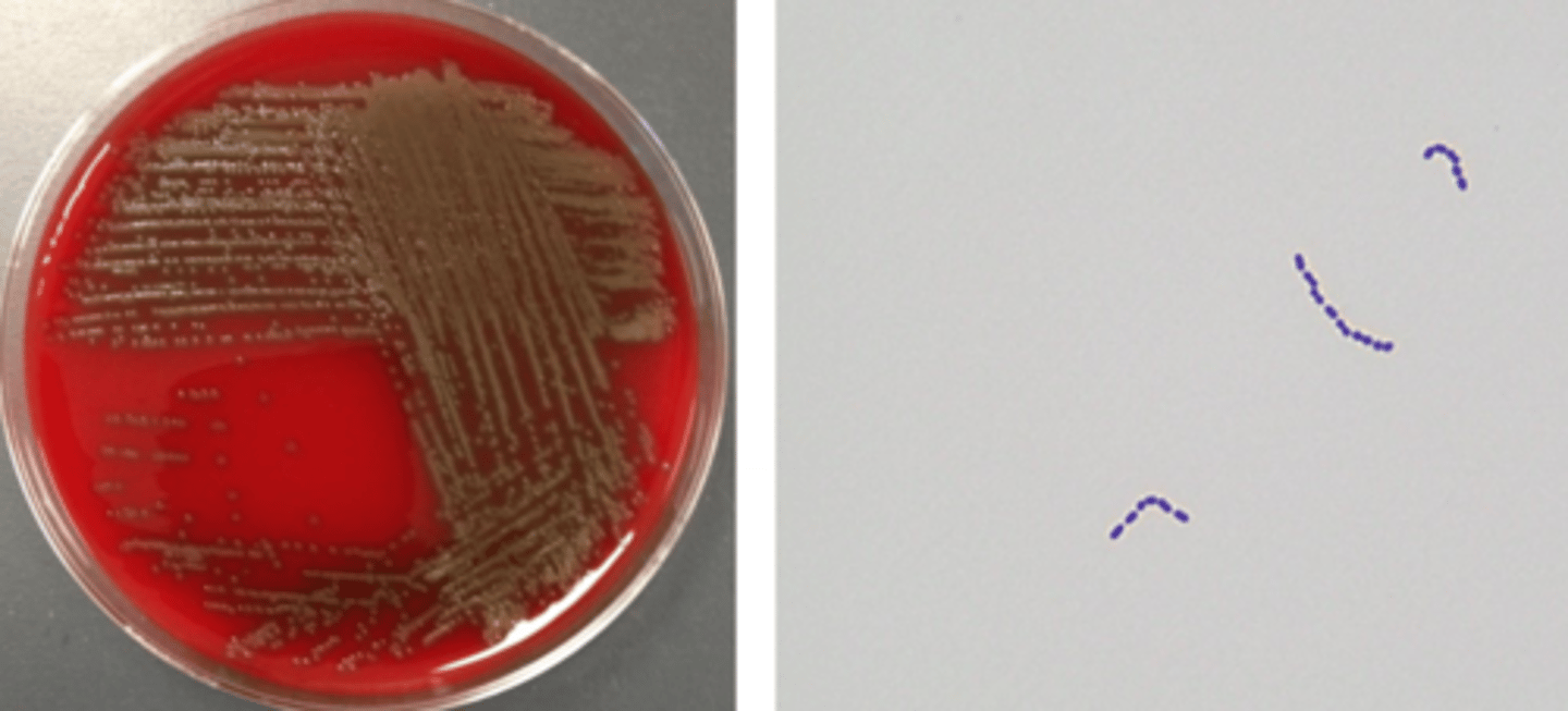 <p>alpha-hemolytic</p><p>cocci in chains</p>