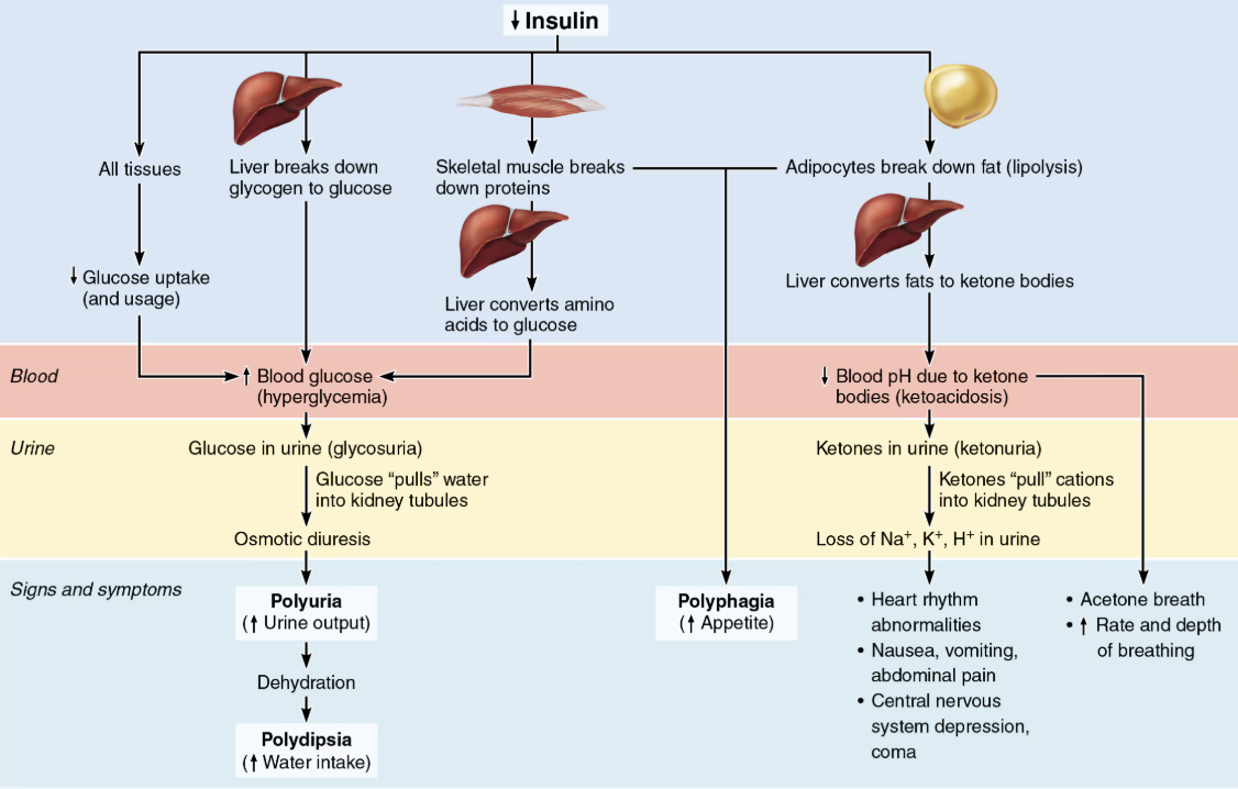 <ul><li><p><strong>Diabetes mellitus (DM) </strong></p><ul><li><p><span><mark data-color="unset" style="background-color: unset; color: inherit;">A chronic metabolic disorder characterized by high blood sugar (glucose) levels due to an imbalance between insulin production and insulin resistance</mark></span></p></li></ul></li><li><p><strong>CAUSES</strong> </p><ul><li><p>Hyposecretion of insulin: Type 1 </p></li><li><p>Hypoactivity of insulin: Type 2 </p></li></ul></li></ul><p></p>