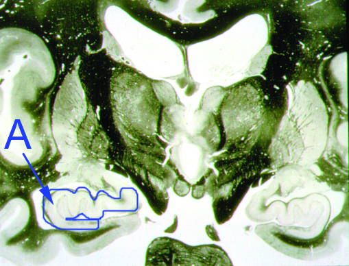 <p>What is the function of structure "A"?</p><p><span>Addictive behaviors center</span></p><p><span>Fear center</span></p><p><span>Consolidation of long term memory center</span></p><p><span>Rage behavior center</span></p><p><span>None of the above</span></p>