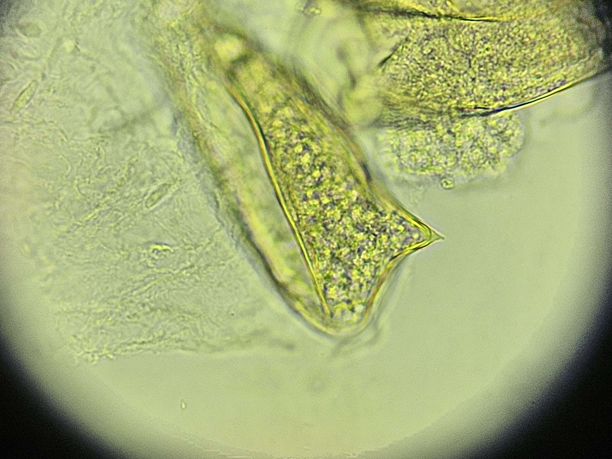 <p><span data-name="microscope" data-type="emoji">🔬</span><span data-name="petri_dish" data-type="emoji">🧫</span><strong><span> </span>Na podstawie zdjęcia preparatu:</strong></p><p></p><ul><li><p><span data-name="book" data-type="emoji">📖</span><span> </span>rozpoznaj gatunek pasożyta;</p></li></ul><p></p><ul><li><p><span data-name="recycle" data-type="emoji">♻</span><span> </span>rozpoznaj wszystkie formy rozwojowe;</p></li></ul><p></p><ul><li><p><span data-name="microbe" data-type="emoji">🦠</span><span> </span>wskaż organelle i cechy charakterystyczne dla danego gatunku;</p></li></ul><p></p><ul><li><p><span data-name="mask" data-type="emoji">😷</span><span> </span>nazwij chorobę, którą pasożyt wywołuje.</p></li></ul><p></p>