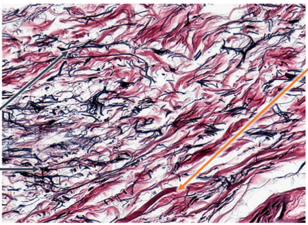 <p>What is this and what are the arrows pointing at?</p>