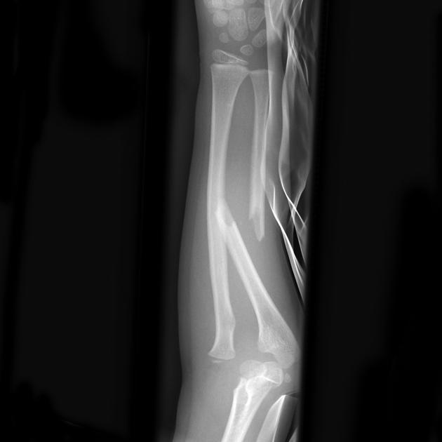 <p>Describe the abnormality demonstrated. </p>