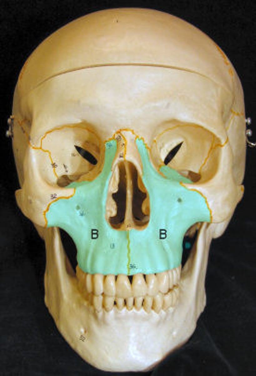 <p>Facial bones (2). Upper jaw.</p>