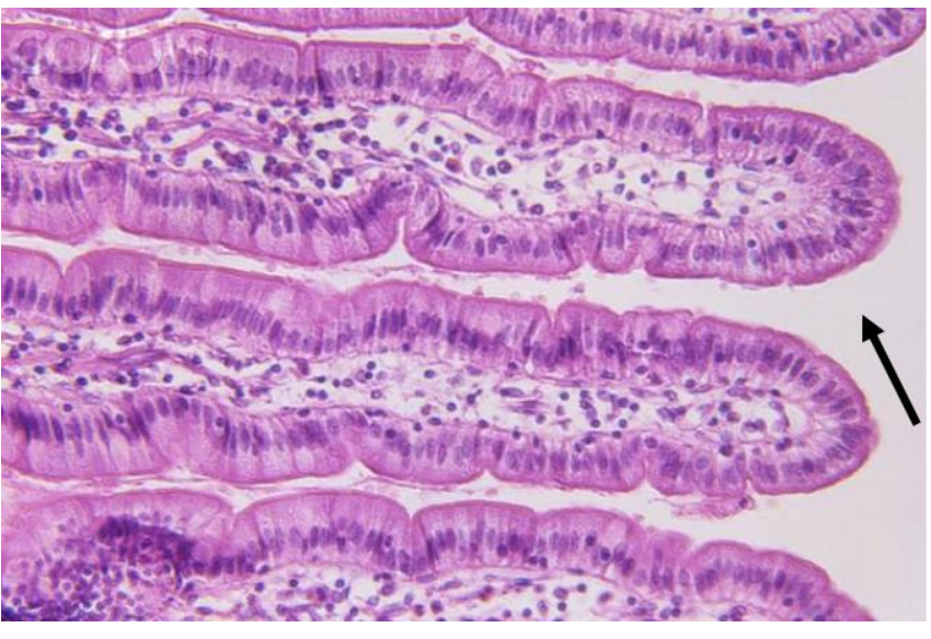 <p>What is the arrow pointing to (open space)?</p>