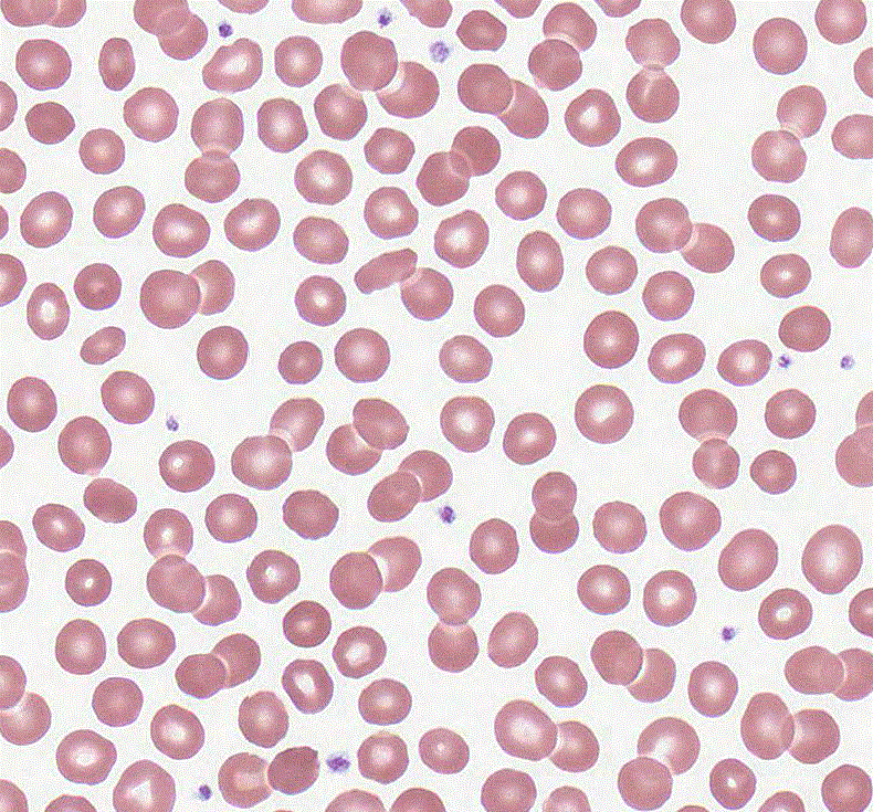 <p>How many platelets are visible in the image?</p>