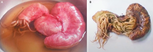 <ol><li><p>migration </p><ul><li><p>L2 get lost + die</p></li><li><p>ex. spleen, liver, brain </p><ul><li><p>inflammation </p></li><li><p>granuloma (contains the threat from spreading) </p></li></ul></li></ul></li><li><p>pulmonary </p><ul><li><p>L2 damage lung capillaries </p></li><li><p>blood pools + tissue damage </p></li><li><p>lung congestion </p></li><li><p>secondary bacterial infection </p></li></ul></li><li><p>Intestinal </p><ul><li><p>pain </p></li><li><p>allergic response to waste (rashes and asthma) </p></li><li><p>obstruction</p></li><li><p>pierce intestine→ peritonitis → death</p></li><li><p>wander </p></li></ul></li></ol><p></p>