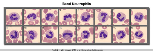<p>most numerous of WBCs</p><p>respond to inflammation→primary defense→phagocytosis</p><p>“bands”: immature nucleus appearance</p><p>“left shift”: more immature than mature neutrophils in blood</p><p>ex: “rise in bands with a left shift"</p>