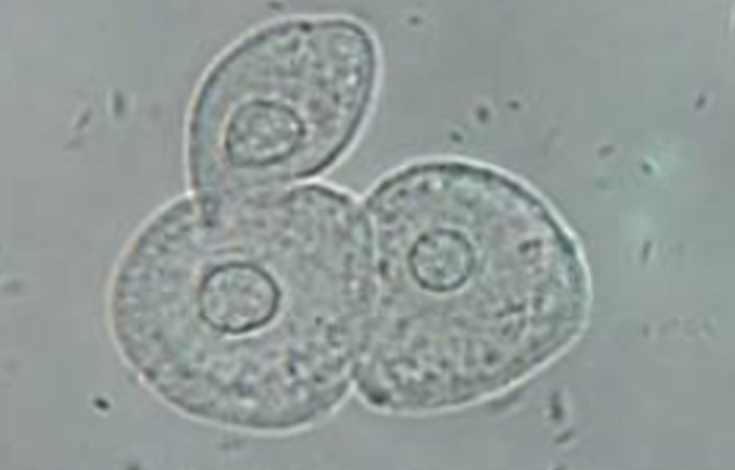 <p>Another type of epithelial cell, also known as a urothelial cell. It is smaller than a squamous epithelial cell and has a centrally located nucleus.</p>