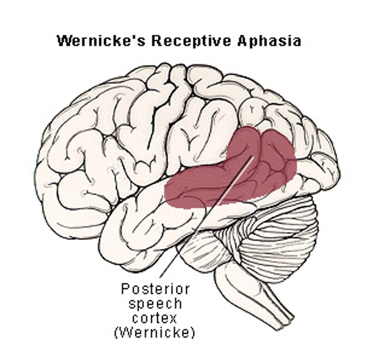 <p>spans the parietal and temporal lobes around the posterior lateral fissure and primary auditory area</p>