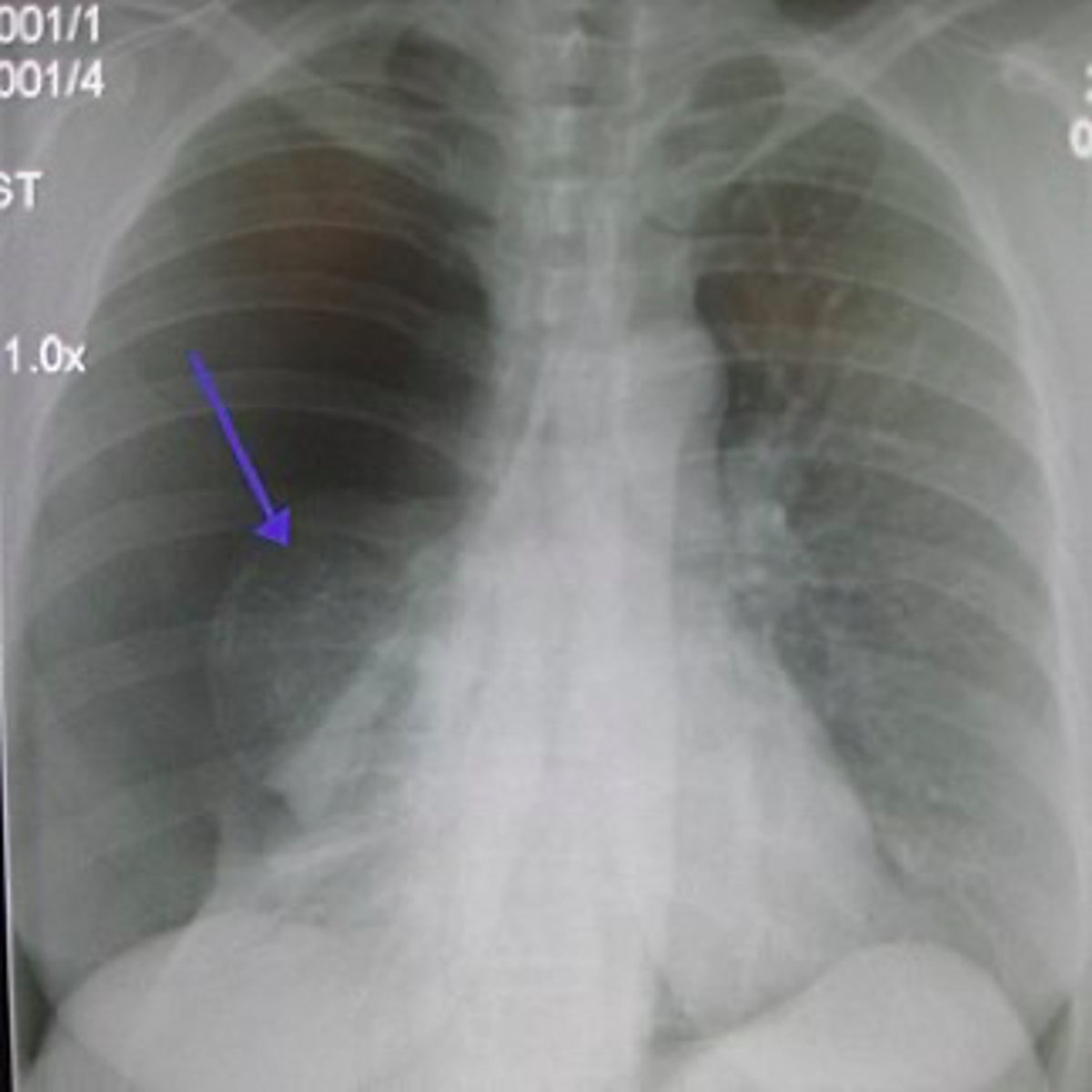 <p>what is the diagnosis?</p>