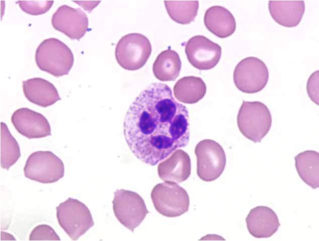 <p>The most numerous WBC (<span>2-7.5x10^9/L)</span>, responsible for non-specific immune responses and contains granules in the cytoplasm:</p><ul><li><p><span>Primary granules: Contain lysozyme and other digestive enzymes.</span></p></li><li><p><span>Secondary granules: Contains lysozyme and collagenase.</span></p></li></ul><p></p>