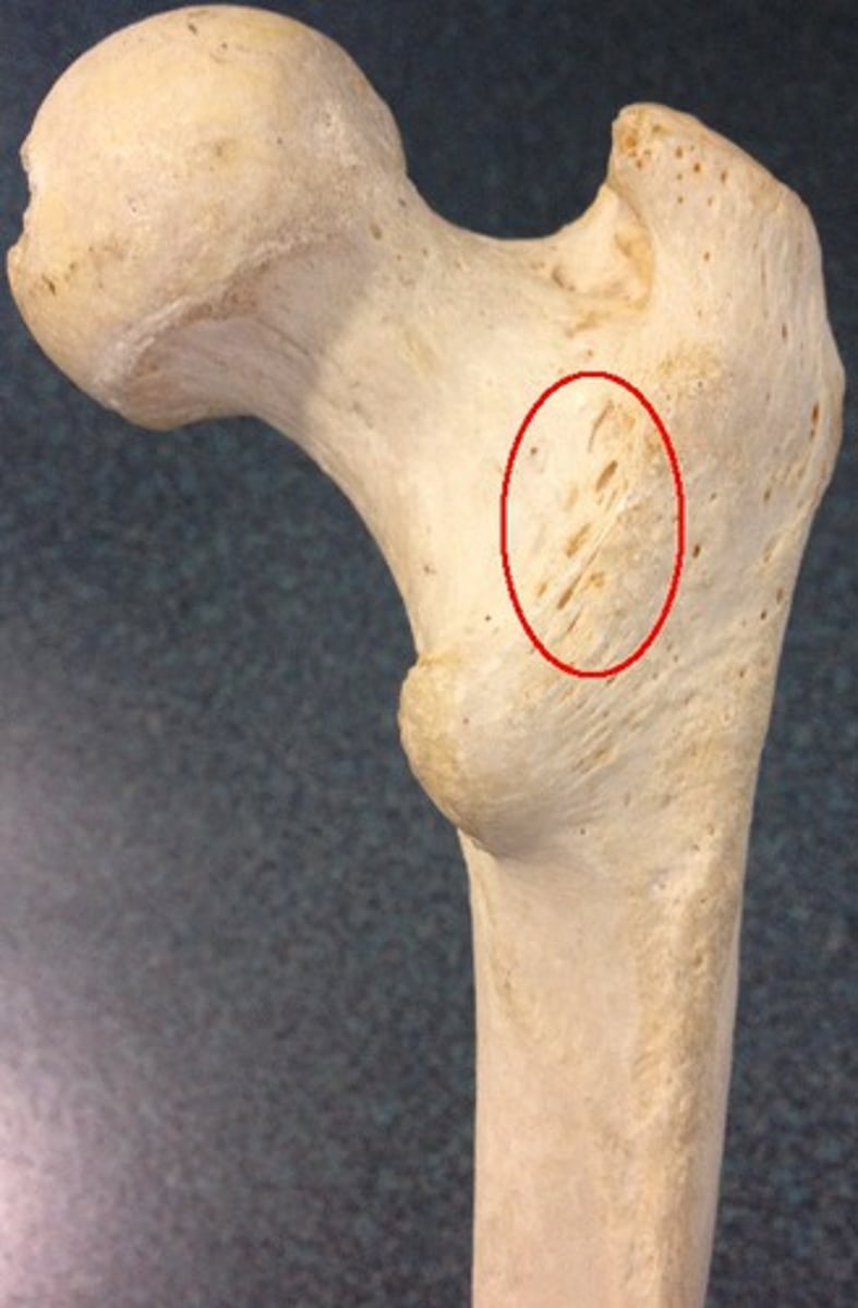 <p>Raised area formed posteriorly between the Greater and Lesser Trochanters</p>