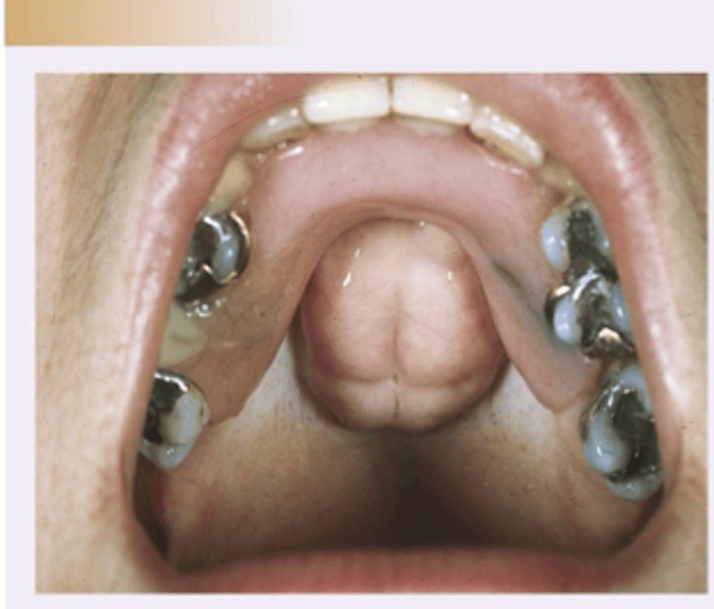 <p>Diagnosis?</p>