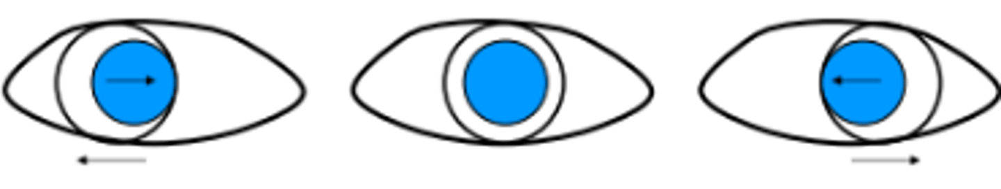 <p>With eye movement the GPCL will move to the limbus in the ____ direction to the direction of movement</p>