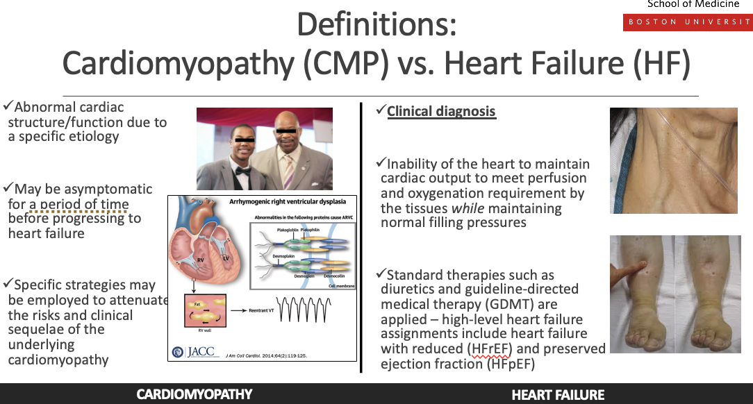 <ul><li><p><strong>Cardiomyopathy</strong> is a <strong>disease of the heart muscle</strong> that causes structural or functional abnormalities (e.g., dilated, hypertrophic, restrictive).</p></li><li><p><strong>Heart failure</strong> is a <strong>clinical syndrome</strong> where the heart cannot pump enough blood to meet the body’s needs, often <strong>resulting from cardiomyopathy</strong> or other heart diseases.</p></li><li><p><span style="background-color: transparent;"><span>Cardiomyopathy (CMP)</span></span></p><ol><li><p><span style="background-color: transparent;"><span>Abnormal cardiac structure and function due to a specific etiologuy</span></span></p></li><li><p><span style="background-color: transparent;"><span>May be asymptomatic for a period of time before progressing to hf</span></span></p></li><li><p><span style="background-color: transparent;"><span>Specific strategies may be employed to attenuate the risks and clinical sequale of the underlying cardiomyopathy </span></span></p></li></ol></li><li><p><span style="background-color: transparent;"><span>Clinical diagnosis *heart faleure)</span></span></p><ol><li><p><span style="background-color: transparent;"><span>Inablituy to maintain cardiac output to meet perfusion and oxygenation requirement by tissues while maintaining normal filling pressure</span></span></p></li><li><p><span style="background-color: transparent;"><span>Standand therapies such as diuretics and guideline-directe medical therapy (GDMT) are applied- hgih lelved heart faieure assingemnts include heart fialure with reduced ejection fraction and preserved ejeciton fraction</span></span></p></li></ol></li></ul><p></p>