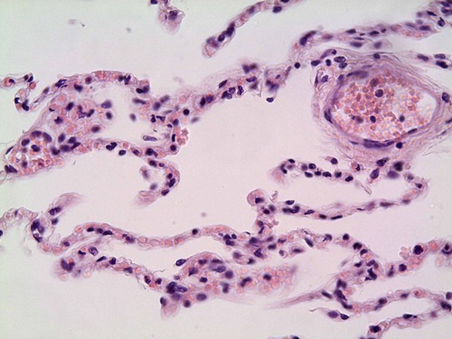 <p>single layer of flattened cells</p>