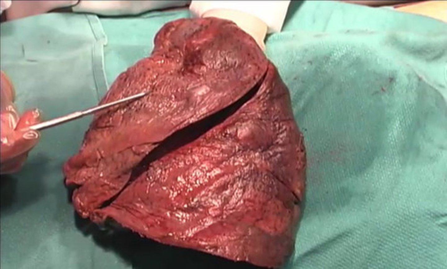 <p>What is this structure?</p><p>superior lobe of right lung</p><p>superior lobe of left lung</p><p>inferior lobe of right lung</p><p>inferior lobe of left lung</p>