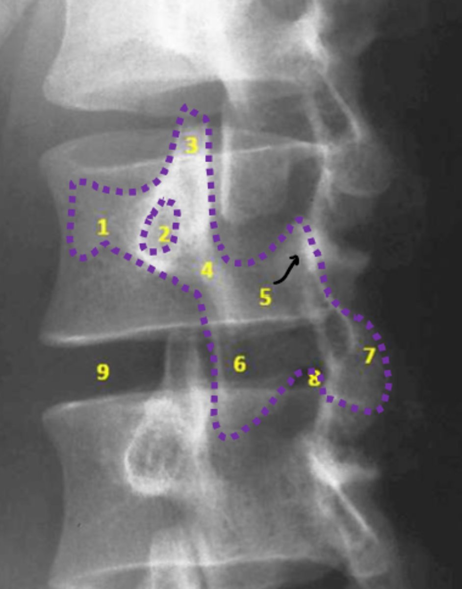 <p>What condition is being examined for in this radiograph?</p><p>What structure is it looking for?</p><p>What view is this radiograph in?</p>