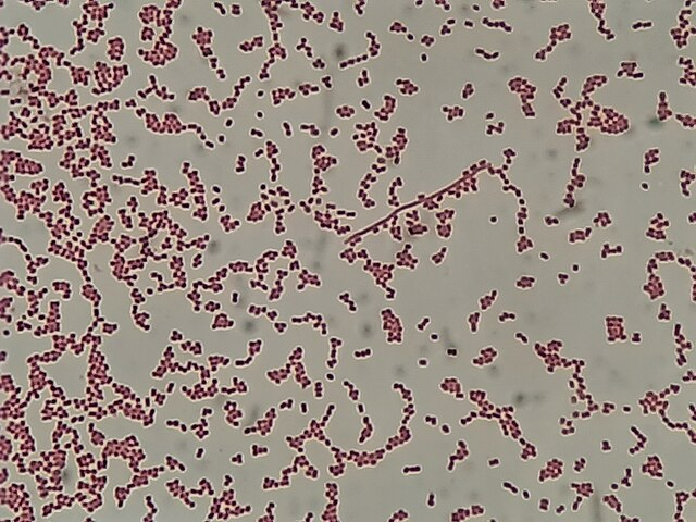 <p>How would you report this stain?</p>