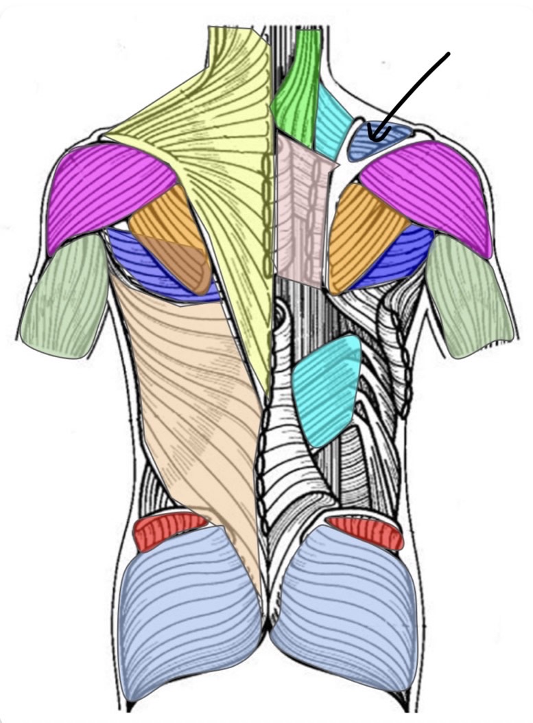 term image