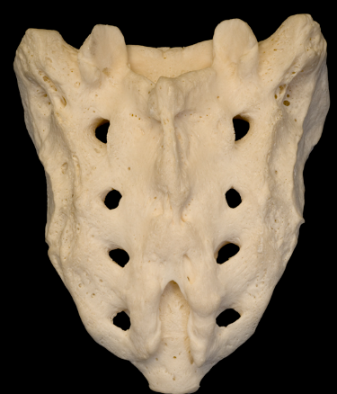 <p>What is this bone called?</p>
