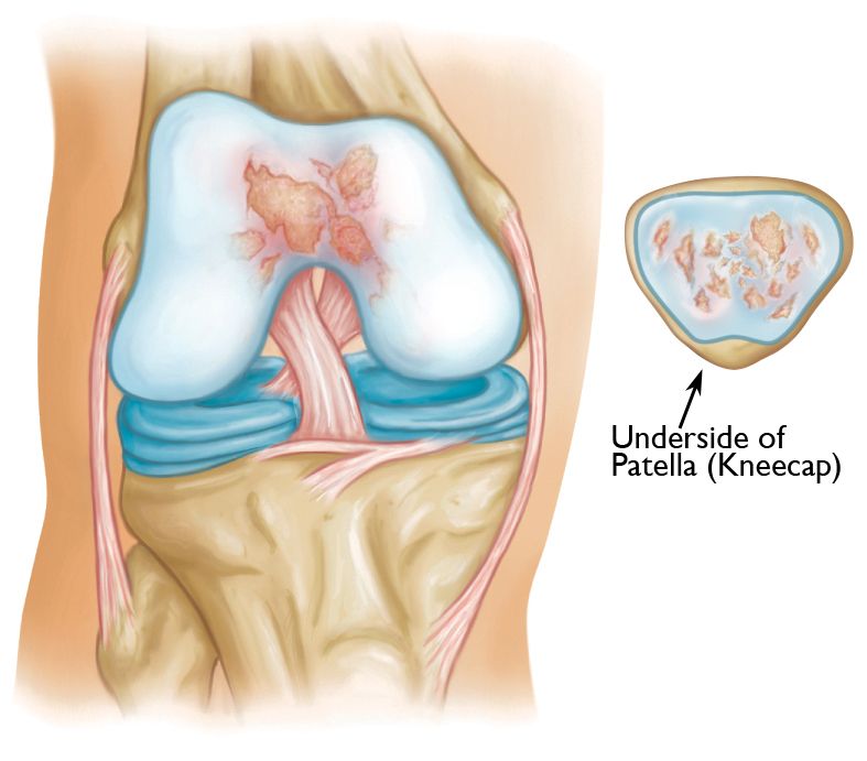 <p>-allows gliding motion along femur during knee flexion</p>