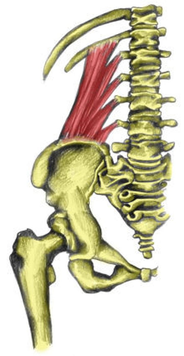 <p>Origin: Medial half of the posterior iliac crest and iliolumbar ligament<br>Insertion: Transverse processes of L1-L4 and medial half of 12th rib</p>