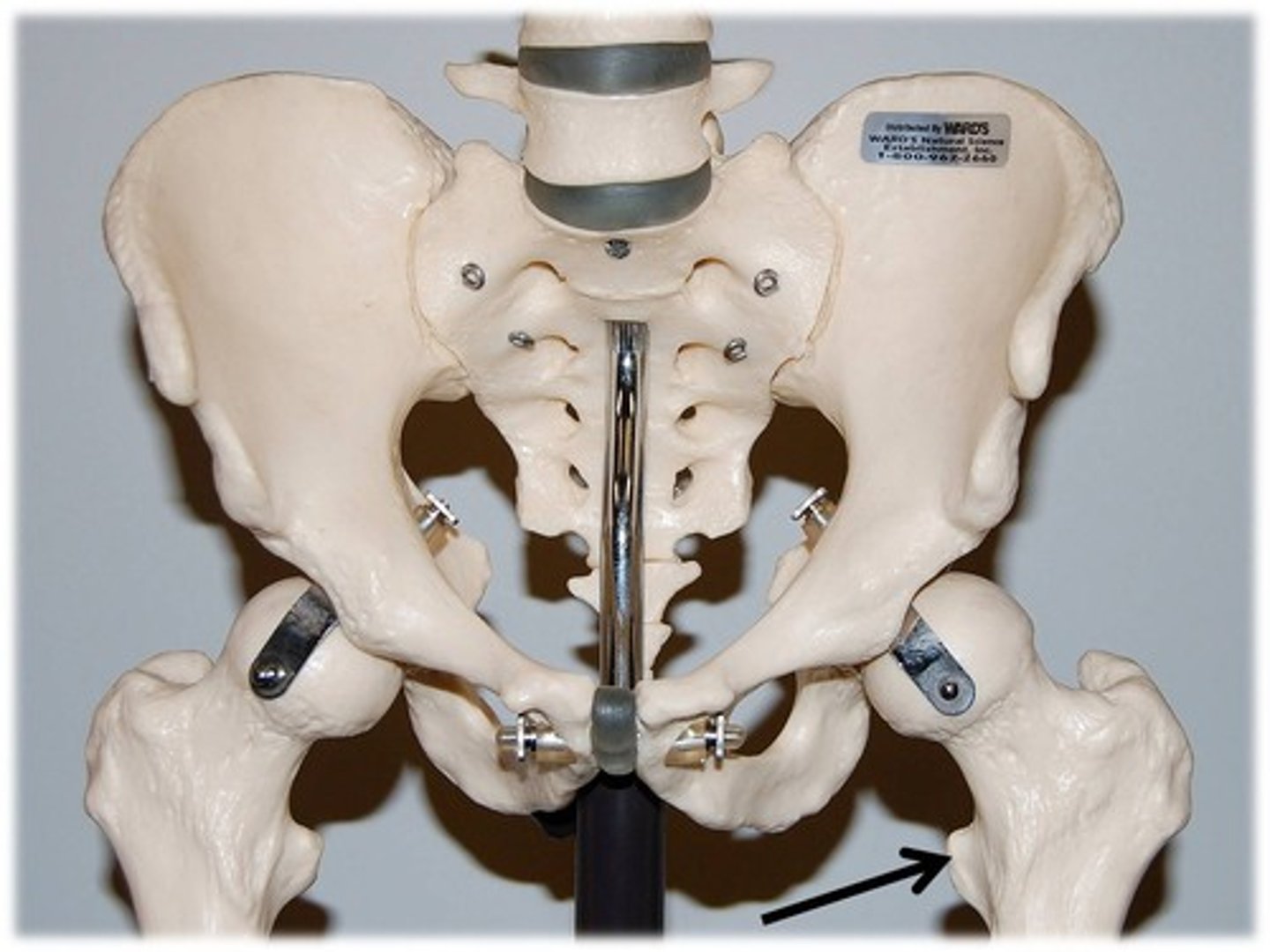 <p>Name this specific part of the femur.</p>