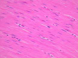 <p>What tissue is this </p>