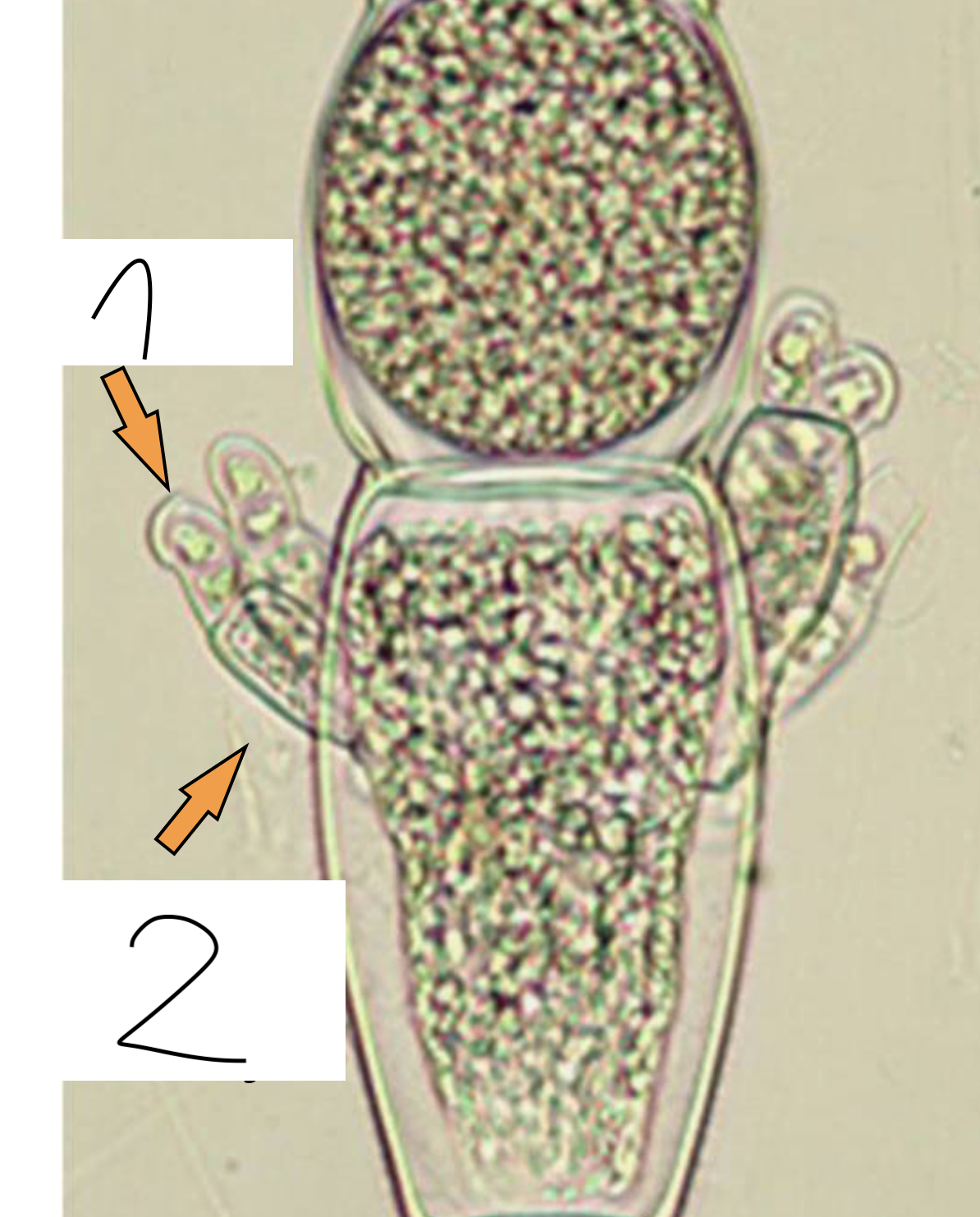 <p>Co jest oznaczone 2?</p>