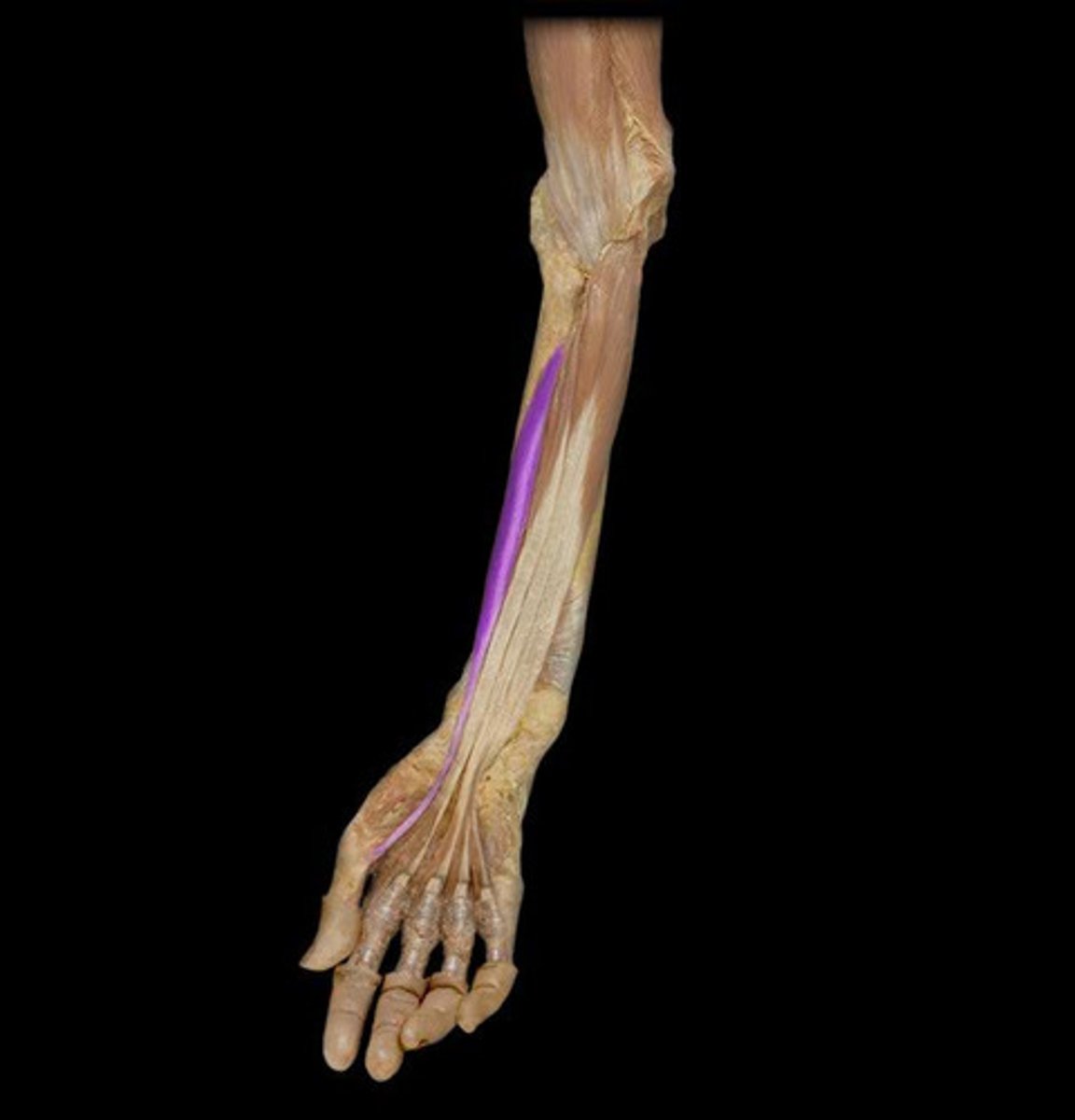 <p>What is this muscle, and what is its action, Proximal &amp; Distal insertions?</p>