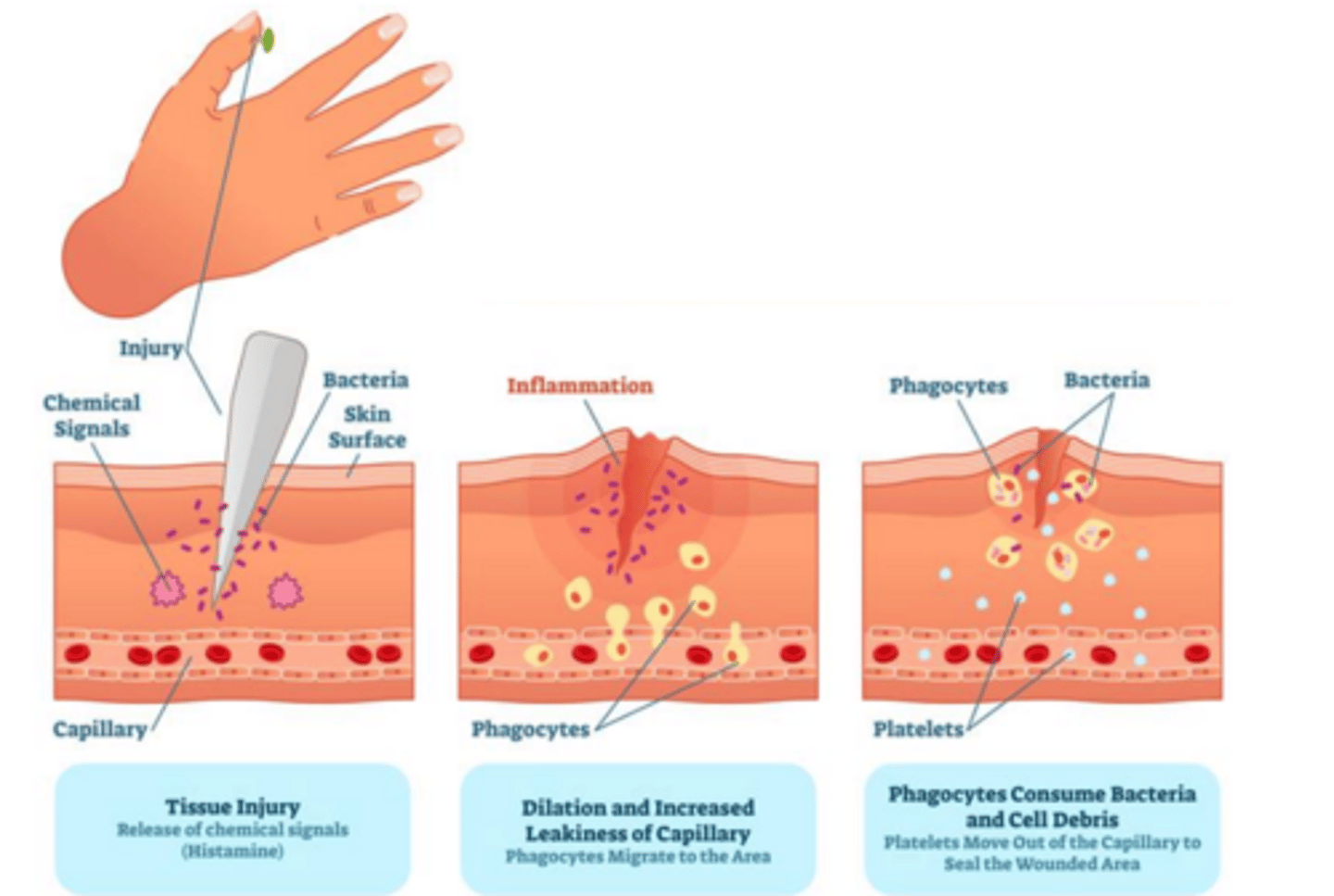 <p>key component of innate immune responses, redness/heat/swelling, histamine is an organic nitrogenous compound produced by immune cells to fight invaders</p>