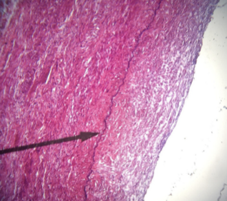 <p>what kind of tissue is this </p>