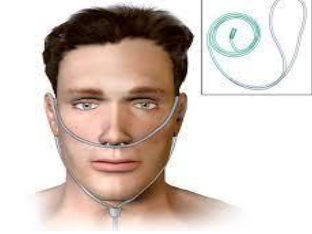 <p>most frequently used<br>low flow through nostrils 21-60%<br>adult LPM: 0.25-8<br>infant LPM: &lt;2</p>