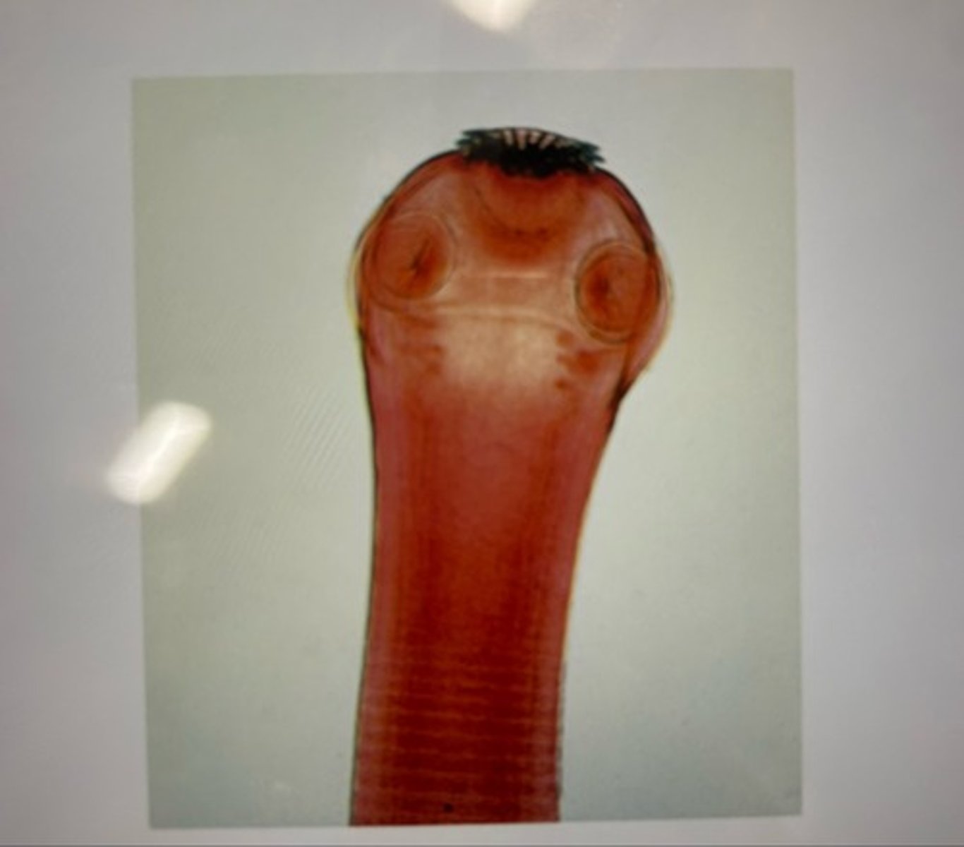 <p>The proglottids closest to the scolex are called ___ proglottids</p>