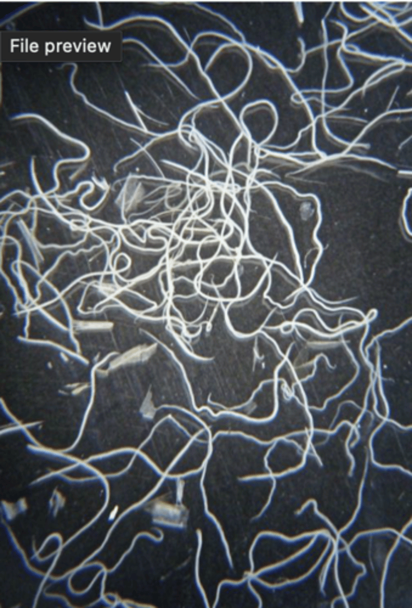 <p>What is this parasite? What characteristic/s did you use to identify it?</p>