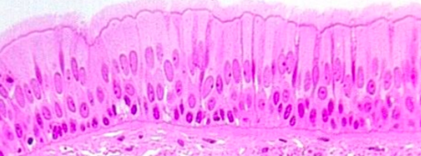 <p>classify this epithelial lining</p>