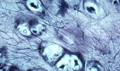 <ul><li><p>matrix contains elastic fibers</p></li><li><p>This tissue is found in the <strong>external ear</strong>, the <strong>Eustachian tubes</strong>, and the cartilage of the <strong>larynx and the epiglottis</strong></p></li></ul><p></p>