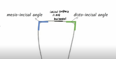 <p>develops from <strong>four developmental lobes</strong>—three <strong>facial lobes</strong> and one <strong>lingual lobe</strong> (which forms the cingulum)</p>