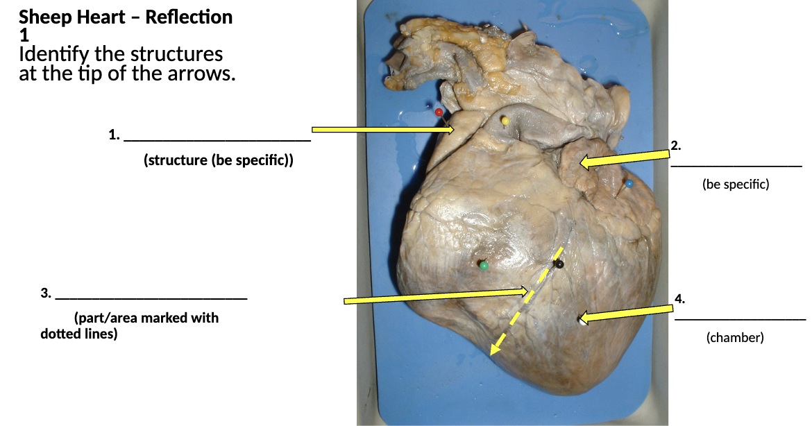 <p>identify the structures at the tip of the arrows (im lowk not sure about this one) </p>