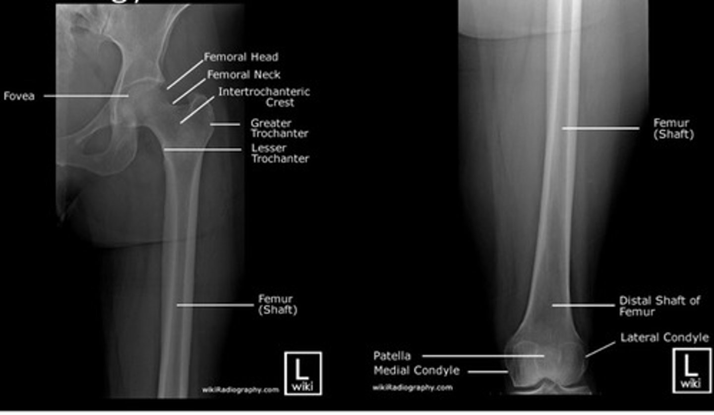 <p>- to include the entire length of the femur and soft tissue borders. The knee and hip joint must be included.</p>