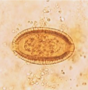 <p><span>What is the genus, species, and stage of this parasite?</span></p><p>• 35 to 45 μm in length by 20-25 μm in width</p><p>• two flat polar prominences and a striated shell</p><p>• unembryonated when passed</p><p>• Smaller than C. hepatica a spurious passage when</p><p>infected liver is eaten</p>