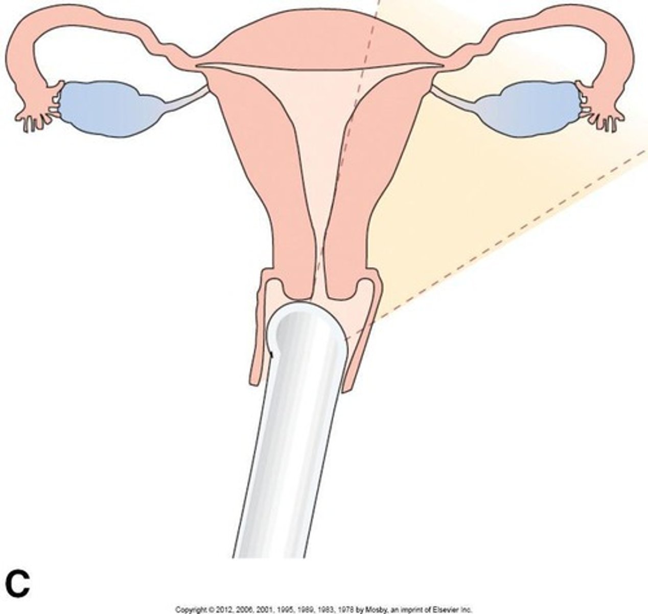 <p>Standardized steps for conducting pelvic ultrasound.</p>