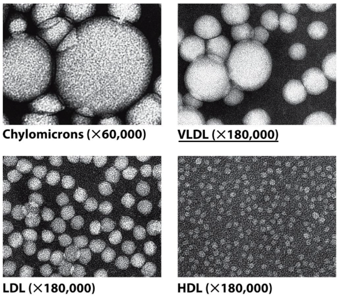 <p>LEAST DENSE Chylomicrons —&gt; very low-density lipoproteins (VLDL) —&gt; intermeidate-density lipoproteins (IDL) —&gt; low-density lipoproteins (LDL) —&gt; high-density lipoproteins (HDL) MOST DENSE</p>