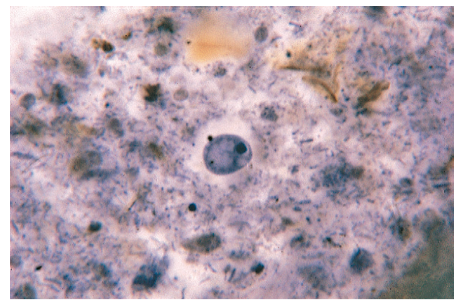 <p>A non-pathogenic ameba.</p>