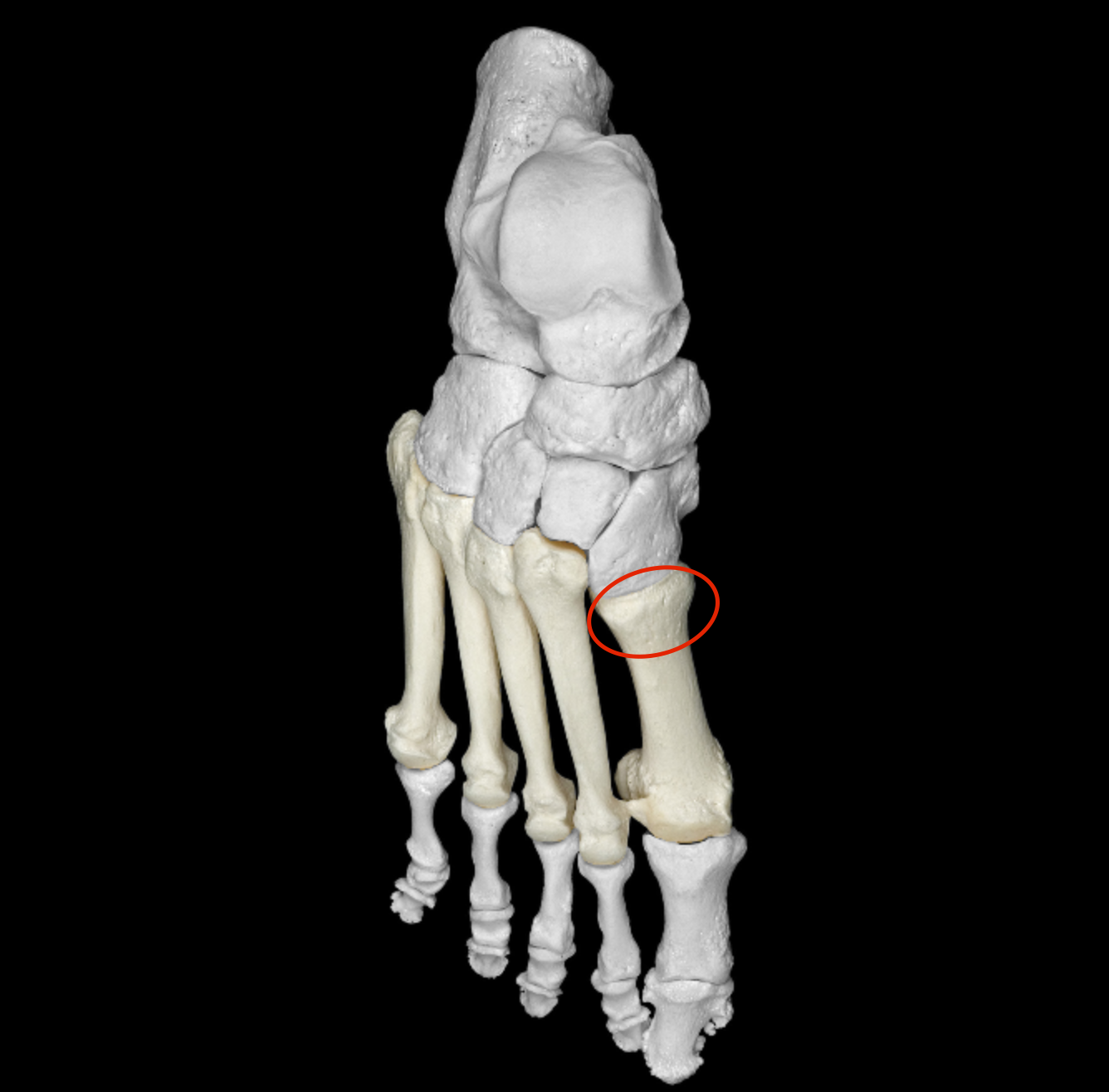 <p>part of metatarsal that articulates with tarsals </p>