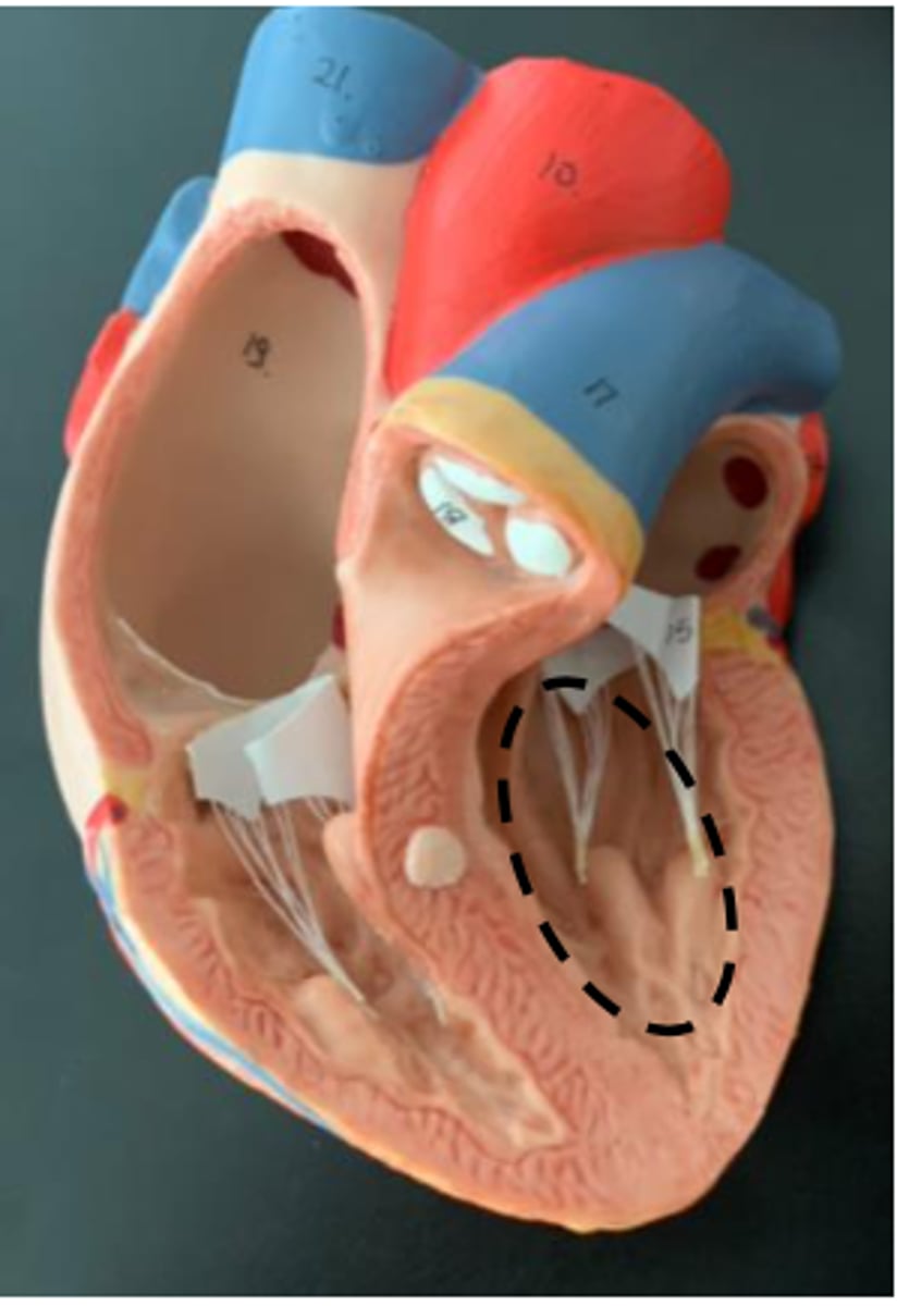 <p>Orange portion above it</p><p></p>
