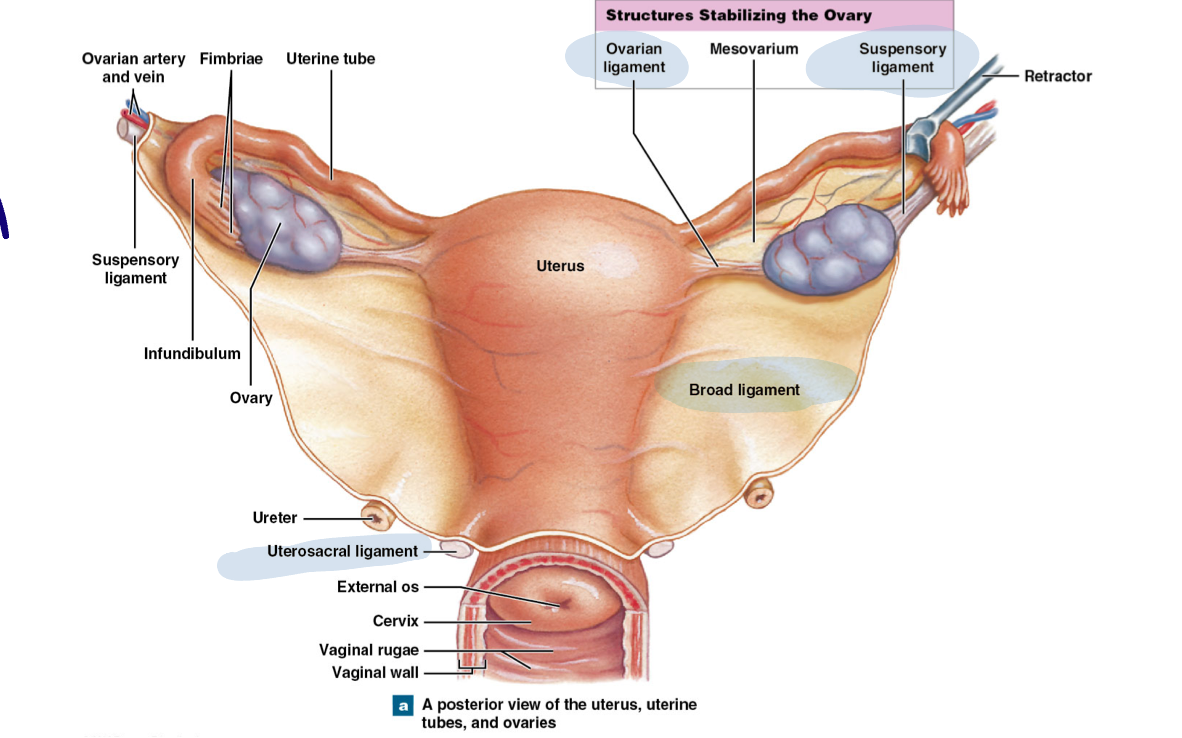 <ul><li><p>Broad ligament: fold of peritoneum that covers the uterus and uterine tubes and attaches to walls of pelvic cavity </p></li><li><p>Ovarian ligament: attaches ovary to the uterus </p></li><li><p>Suspensory ligament: attaches ovaries laterally to pelvic wall</p></li><li><p>Uterosacral ligament: attaches uterus to sacrum</p></li></ul><p></p>