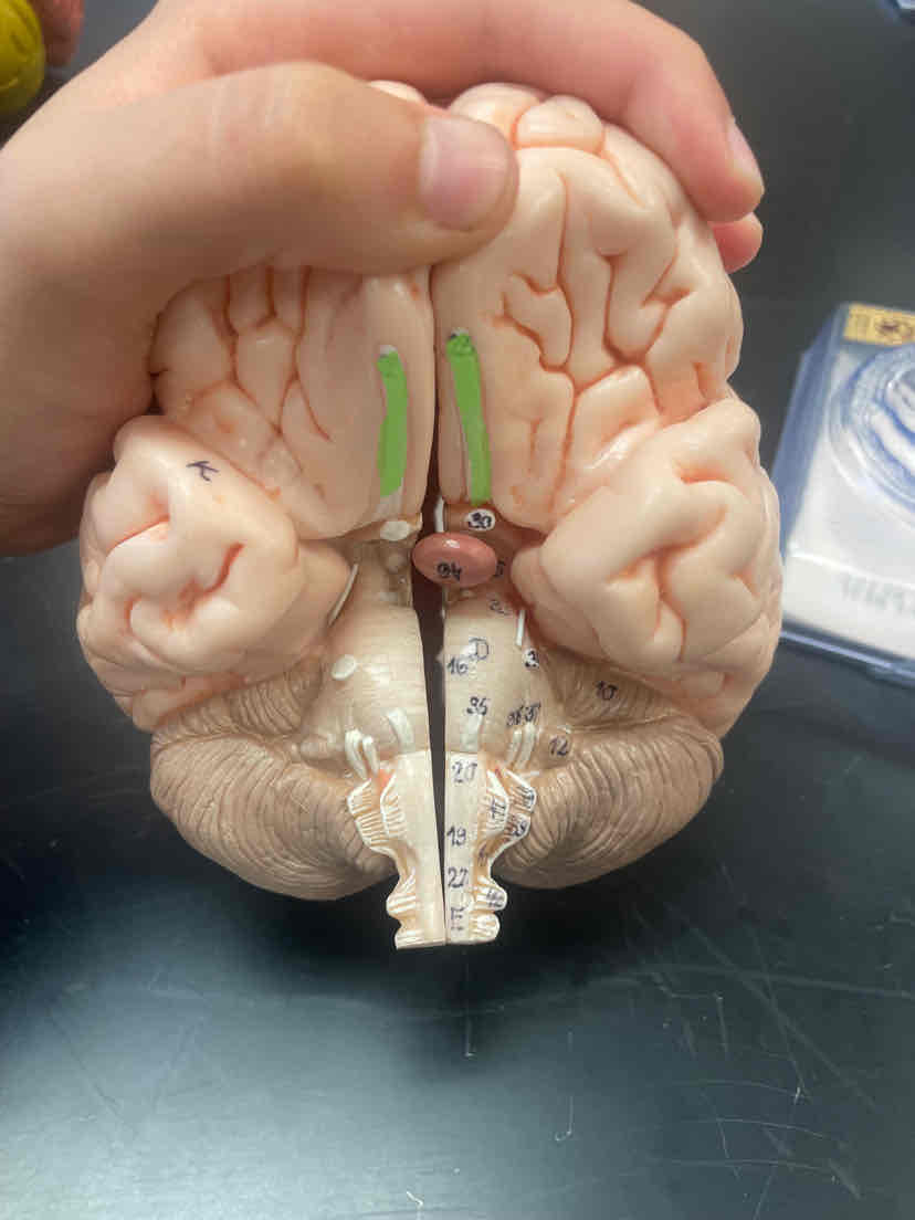 <p>Stripe on the bottom of the frontal lobe</p>